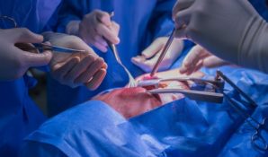 О приостановке применения опасной модели коронарных стентов распространил предупреждение Росздравнадзор