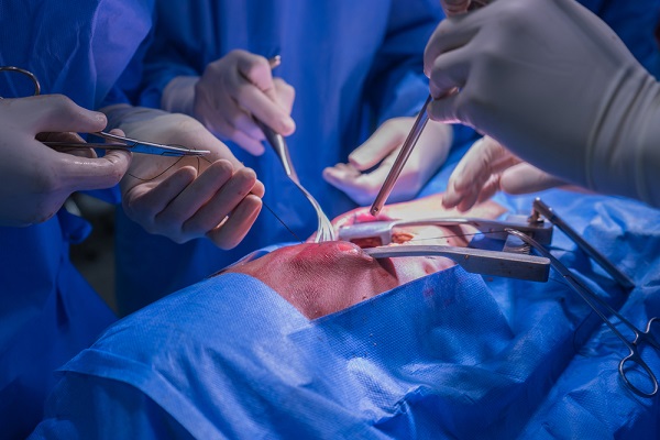 О приостановке применения опасной модели коронарных стентов распространил предупреждение Росздравнадзор