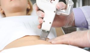 Избавляемся от растяжек и шрамов вместе с салоном красоты «Милан»