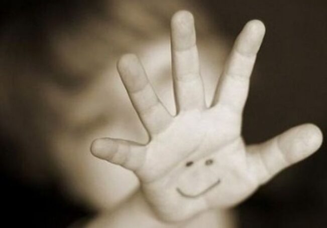 Чужих детей не бывает. Сирийских детей привезли в Россию, чтобы установить современные протезы рук