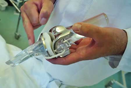 Эндопротезирование суставов в Германии