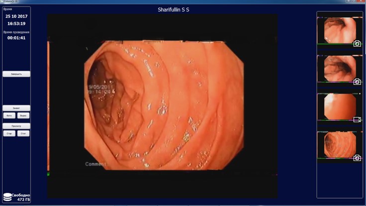Разработанная DICOM Consulting система QColonix способствует повышению эффективности работы медицинских учреждений