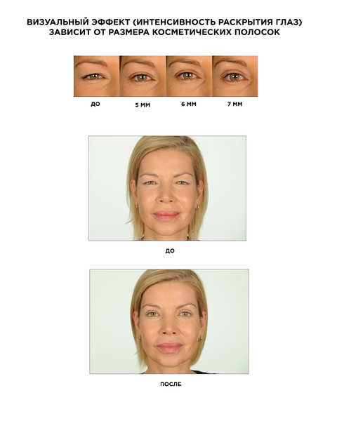 Как подтянуть веки без операции: на Shopping Live появились полоски для лифтинга век мгновенного действия